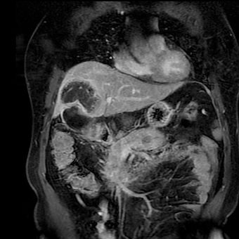 Pregled abdomena